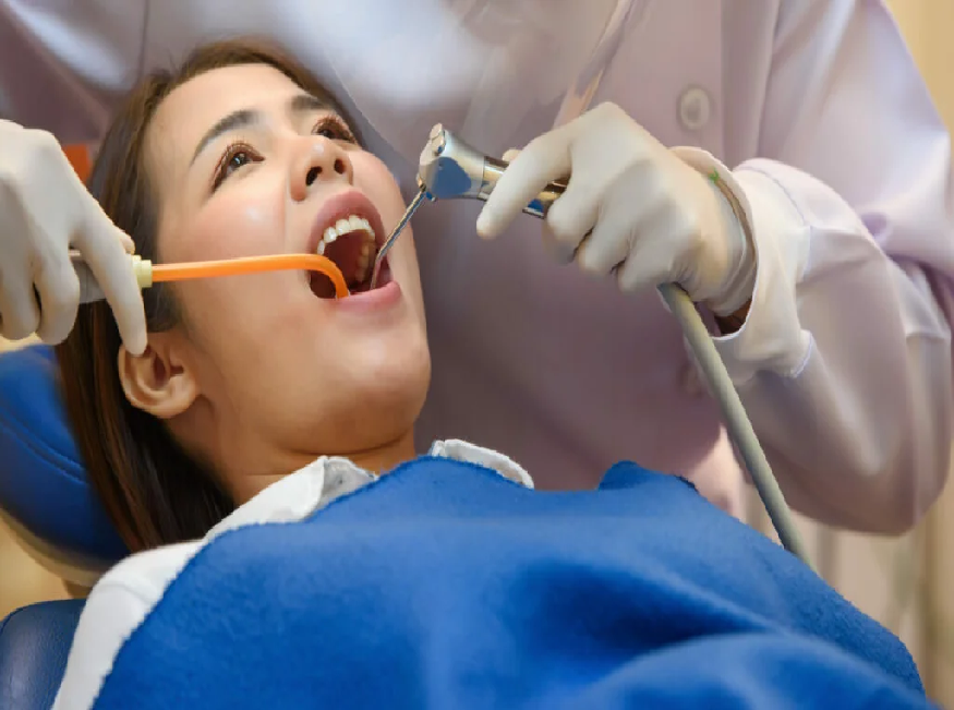 During Dental